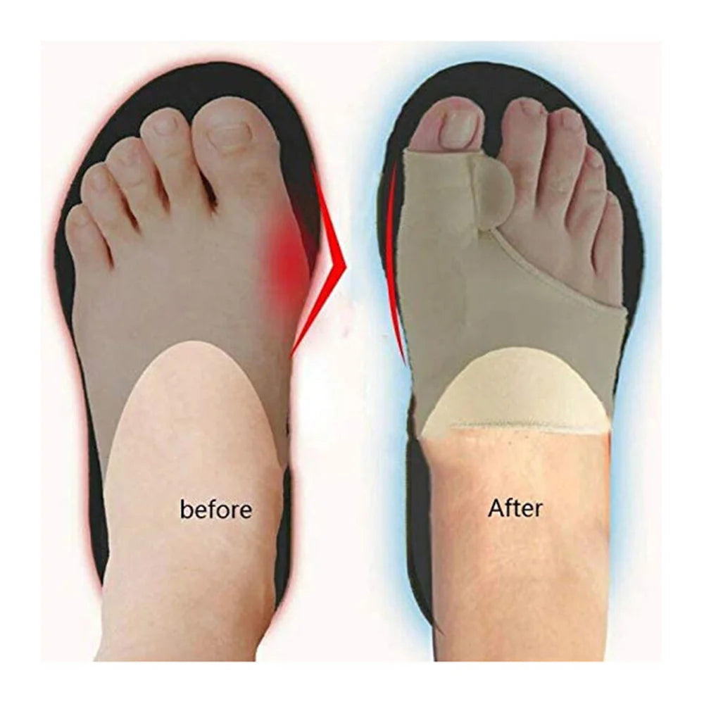 Premium Toe Alignment Comfort Set™